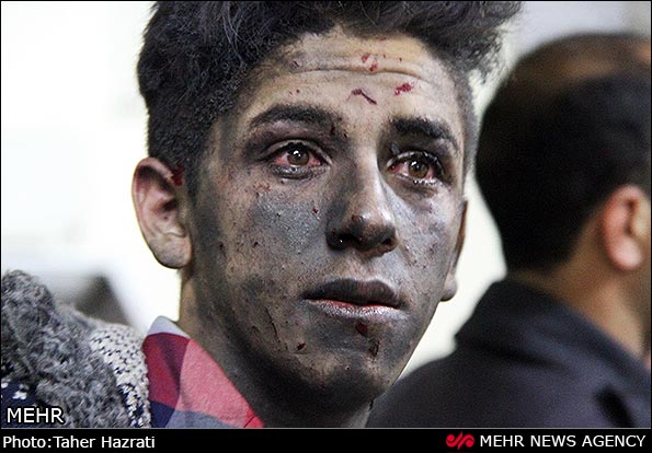 تصاویر/مجروحان و مصدومان چهارشنبه سوری