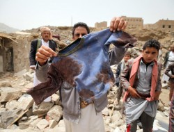 تصاویری دردناک از حملات هوایی به یمن